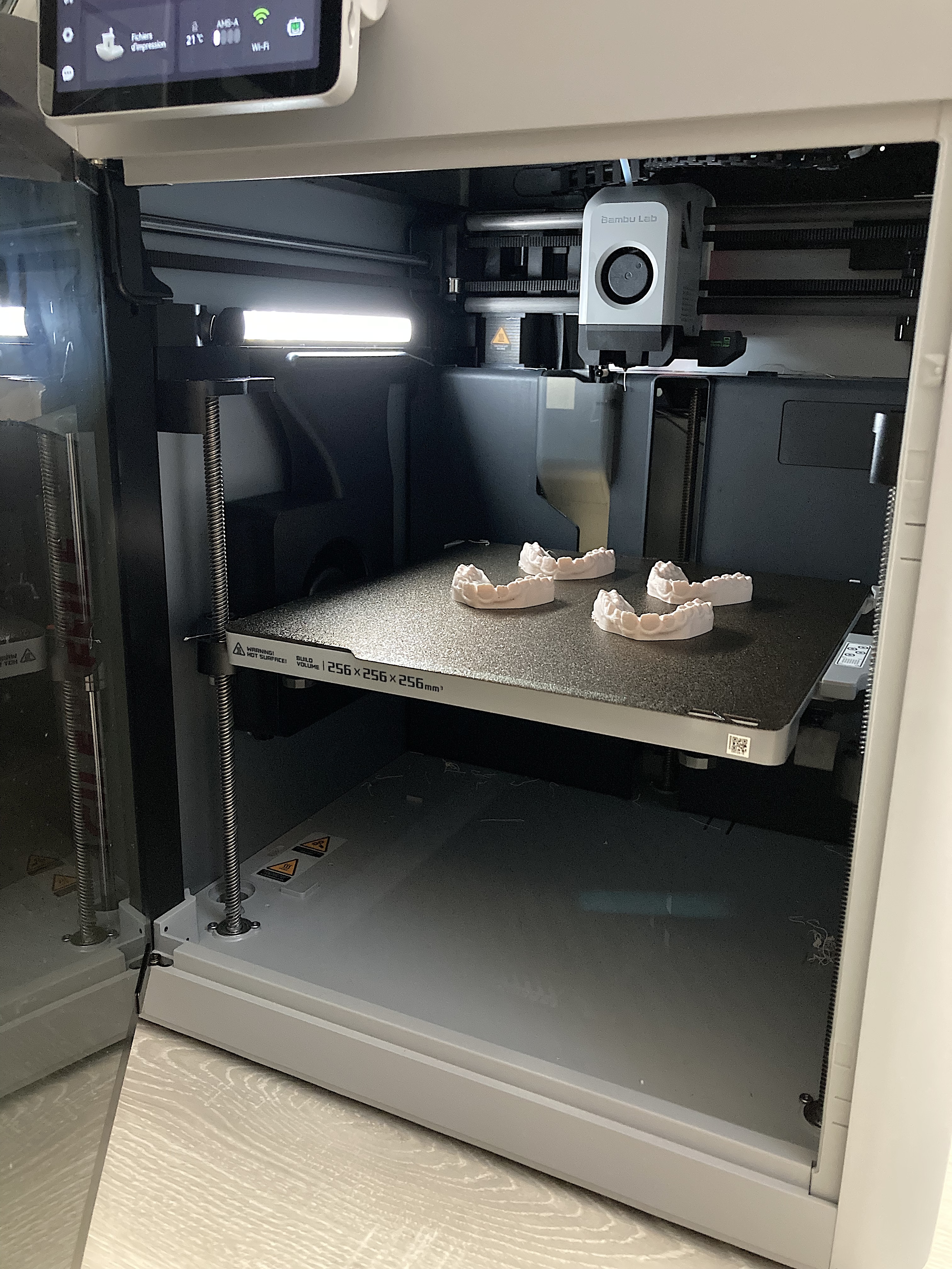 impression 3D des moulages dentaires